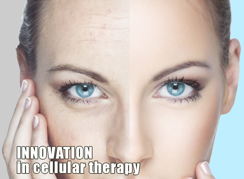 Innovation in Cellular Therapy